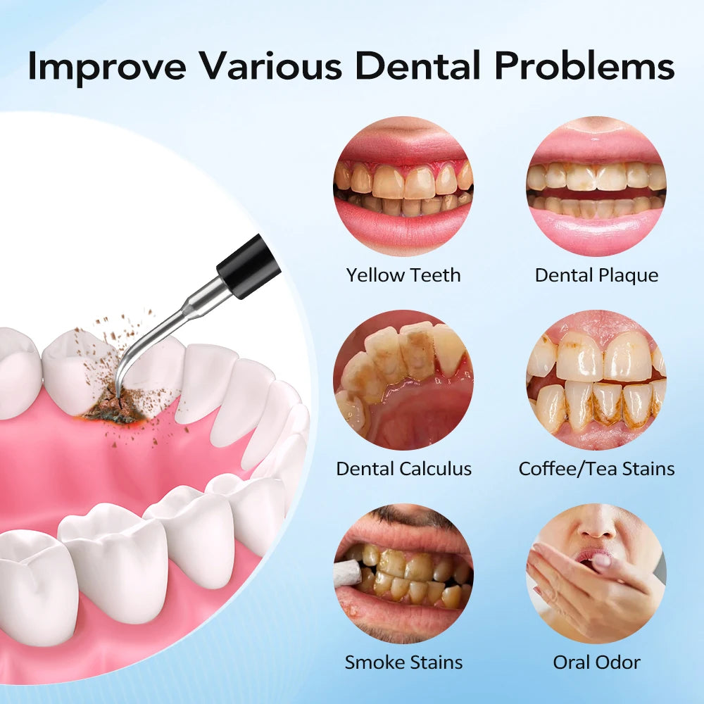 Electric Sonic Teeth Cleaner and Plaque Remover