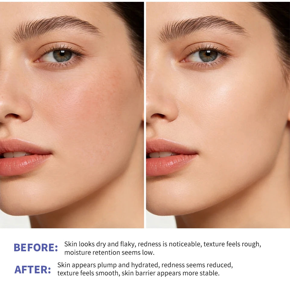 Triple Lipid Peptide Moisturizing Face Cream for Dry Skin