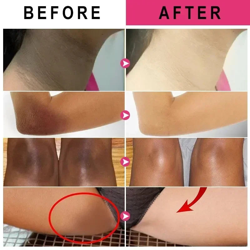 Vitamin C Brightening Cream for Dark Spots and Underarms - 2
