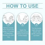 Refreshing Mint Foam Cleaner for Dental Aligners and Retainers