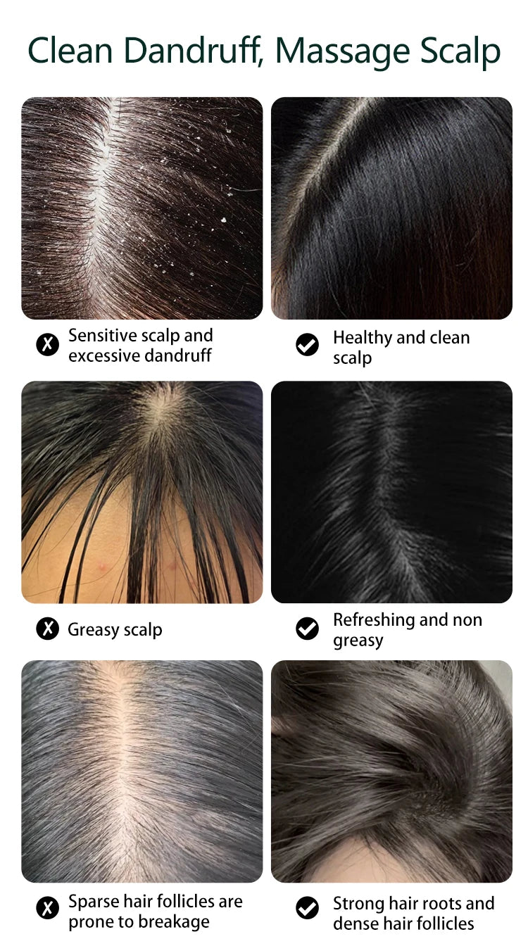 Electric Cordless Scalp Massager for Relaxation and Hair Care
