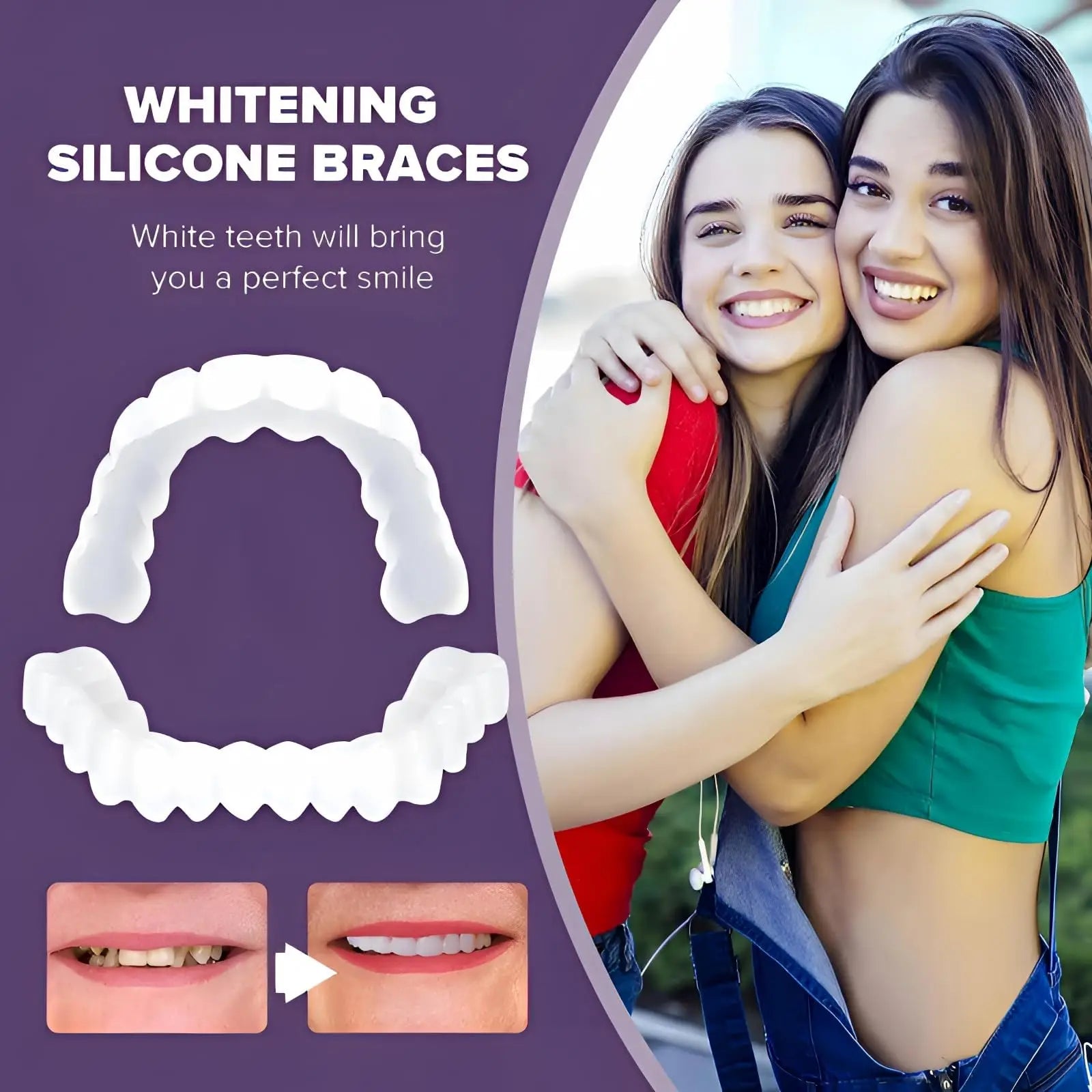 Instant Snap-On Temporary Dentures for Smile Correction - 5
