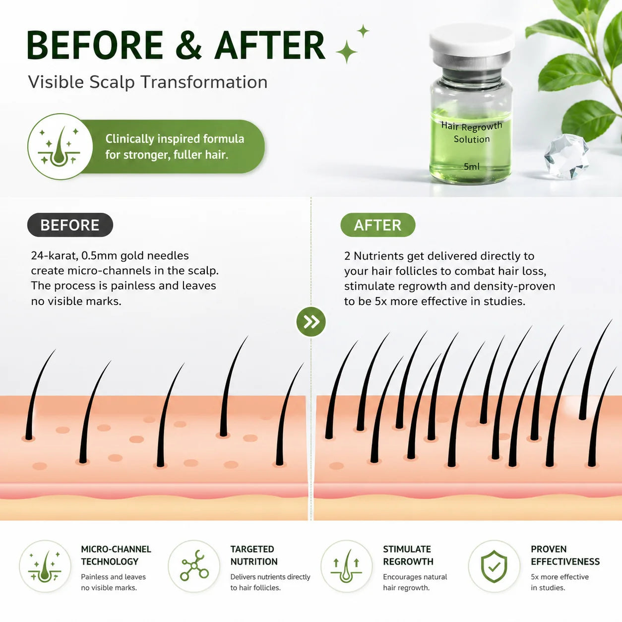 Microneedle Hair Regrowth and Scalp Nourishing Treatment Kit - 6