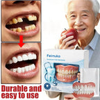 Adjustable Snap-On Cosmetic Dentures for Instant Smile Correction