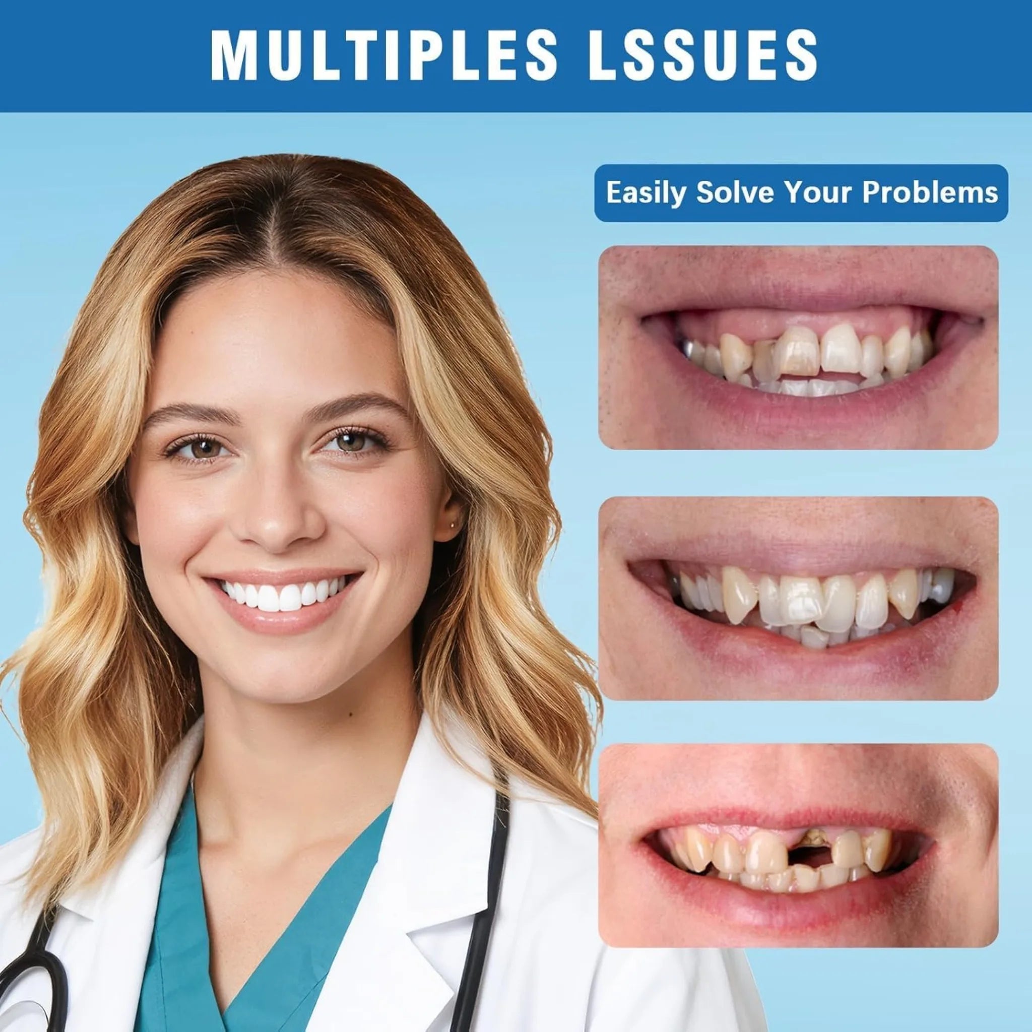 Adjustable Temporary Cosmetic Teeth Veneer Set - 5