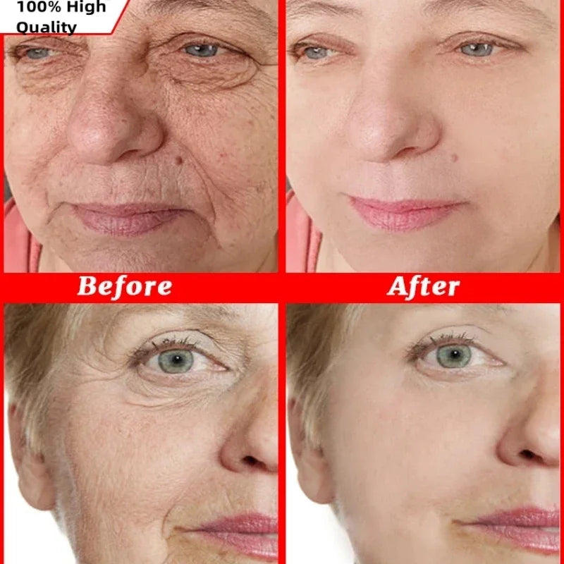 Anti-Wrinkle Lifting and Firming Face Cream