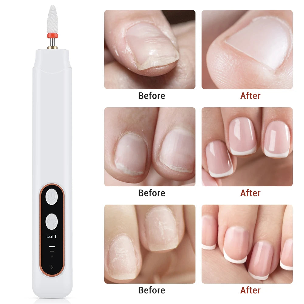 Cordless Electric Manicure and Pedicure Nail File Set