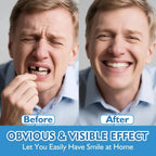 Instant Silicone Cosmetic Dentures for Upper and Lower Teeth