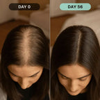 Microneedle Scalp Serum Kit for Hair Regrowth and Follicle Repair