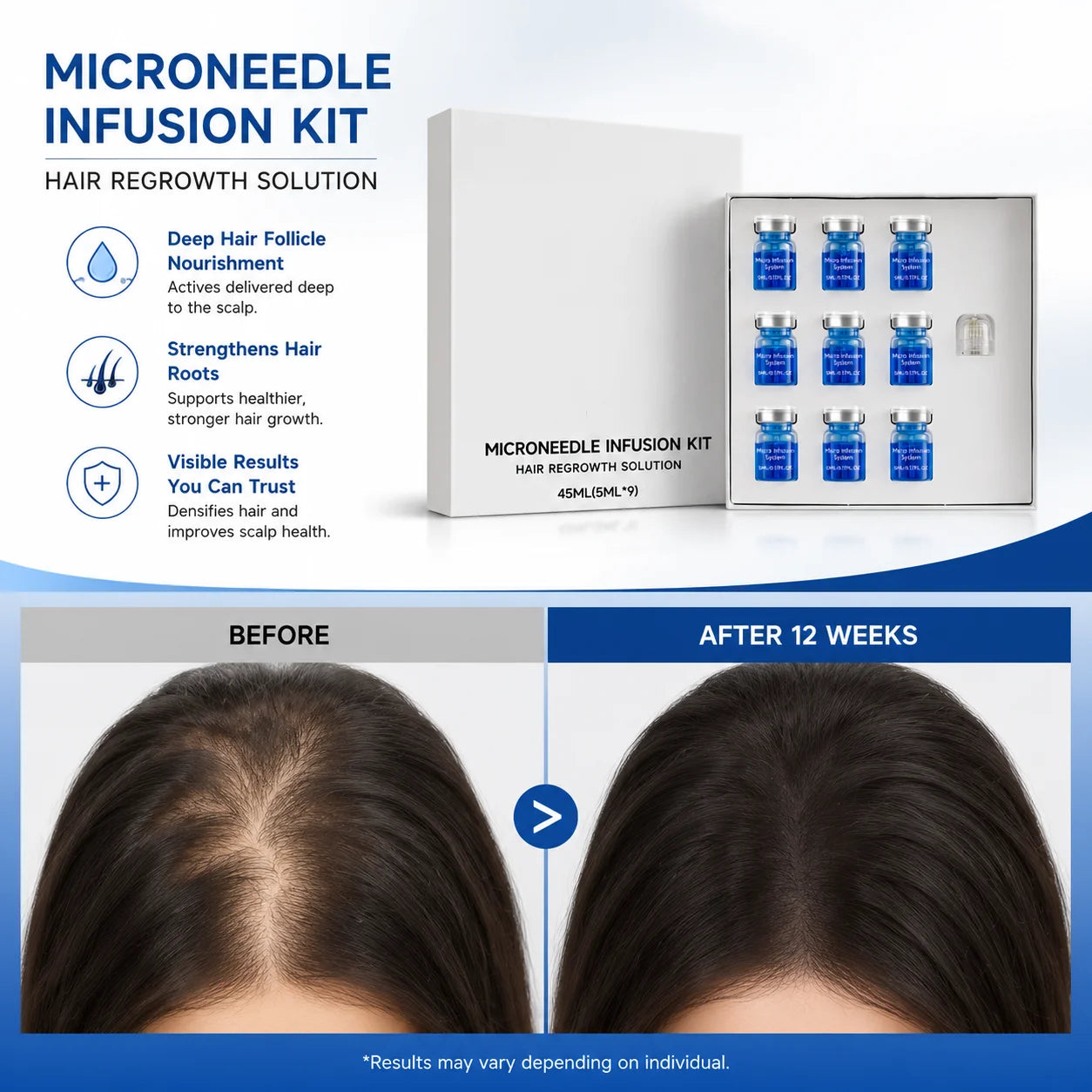 Microneedle Hair Regrowth and Scalp Nourishing Infusion Kit - 4