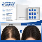 Microneedle Hair Regrowth and Scalp Nourishing Infusion Kit