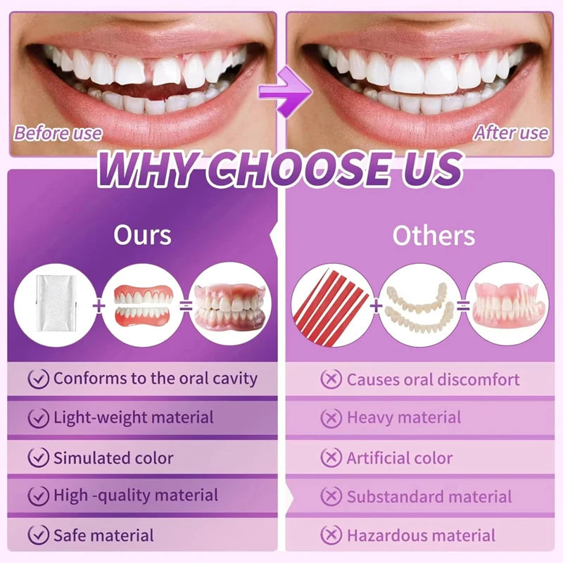 Comfortable Full Set Silicone Dentures for Instant Smile Enhancement