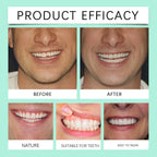 Flexible Silicone Cosmetic Denture Set for Temporary Smile Repair