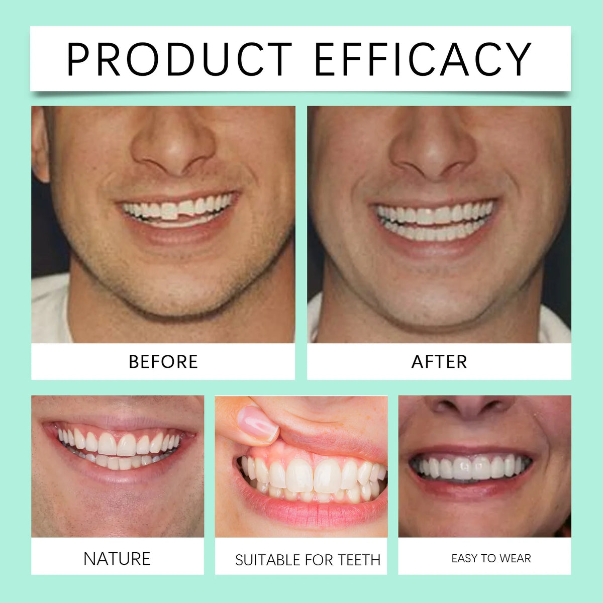 Flexible Silicone Cosmetic Denture Set for Temporary Smile Repair