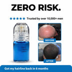 Microneedle Scalp Serum Kit for Hair Regrowth and Follicle Repair
