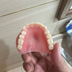 Custom-Fit Silicone Denture Set for Upper and Lower Teeth