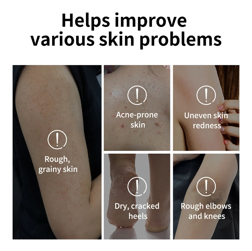 Glycolic Acid Exfoliating Body Stick for Smooth Skin