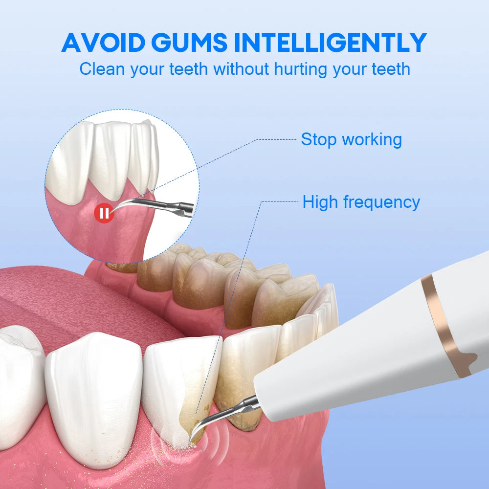 Ultrasonic Electric Teeth Cleaner and Tartar Remover - 3