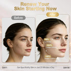 5-in-1 Micro-Current Facial Rejuvenation & Skin Tightening Device