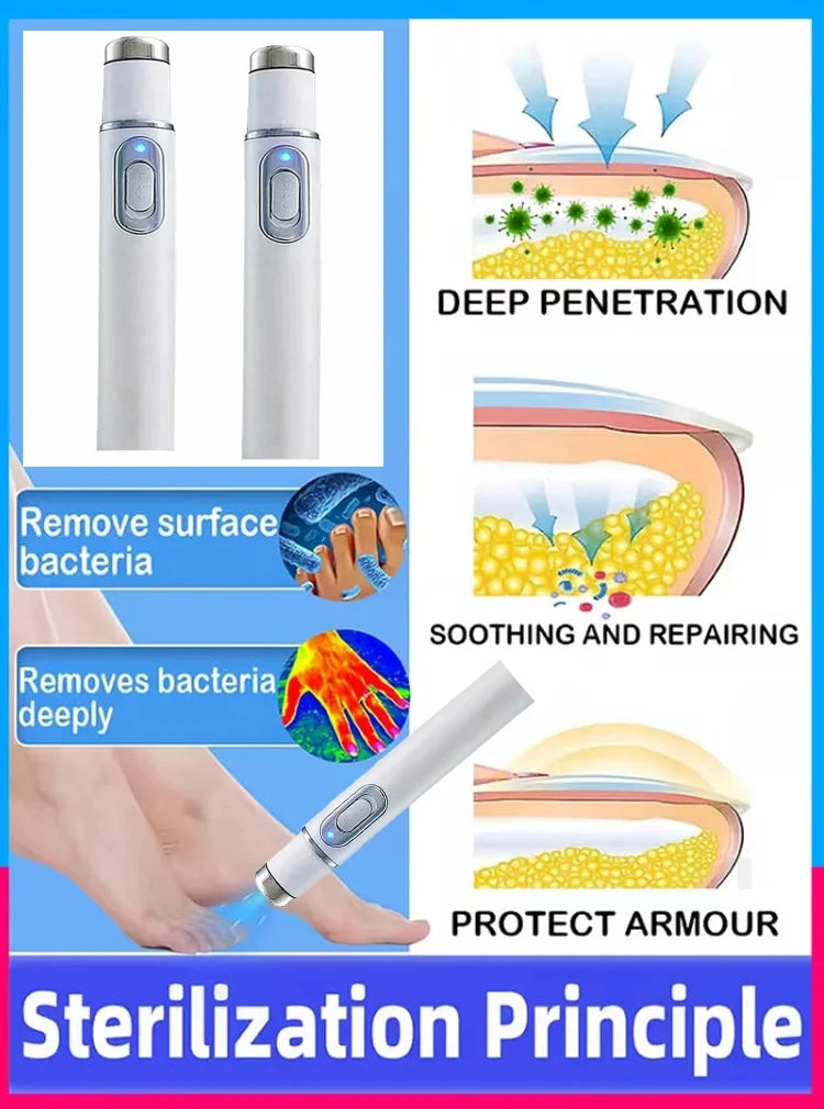 Laser Nail Fungus Treatment Device for Home Use