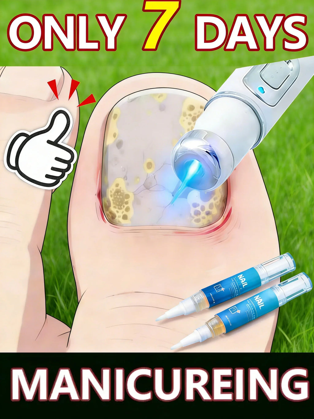 Blue Light Laser Pen for Nail Fungus Treatment and Repair