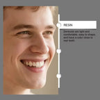 Full Mouth Silicone Dentures for Natural Smile and Oral Comfort