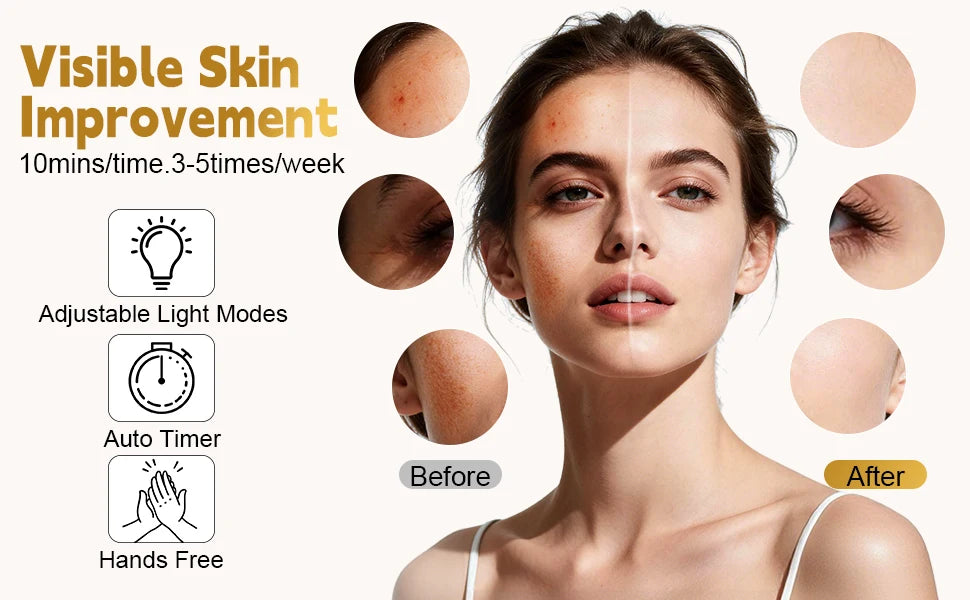 7-Color LED Silicone Facial Mask for Skin Rejuvenation